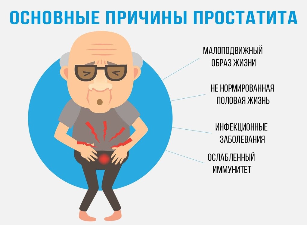 Саяногорск Инфо - Простата и проблемы, связанные с ней - prost.jpg