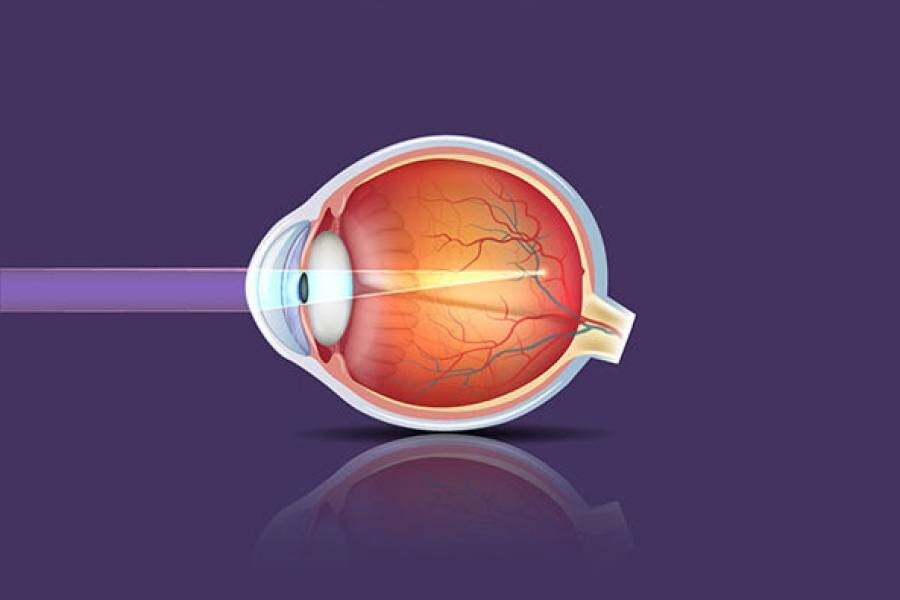 Саяногорск Инфо - Достижения в лечении близорукости - eye.jpg