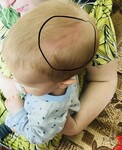 В Хакасии малышка ударилась головой, упав с крыльца