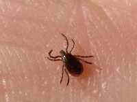 Большинство пострадавших от клещей жителей Хакасии не имели прививок
