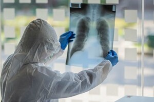 За сутки в Хакасии 65 человек заболели коронавирусом