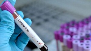За сутки в Хакасии заболели коронавирусом 51 человек, 87 выздоровели