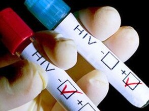 Абакан и Саяногорск удвоили число ВИЧ-инфицированных