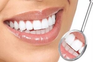 Саяногорск Инфо - Надежная имплантация зубов в клинике Рецепт улыбки - smile3.jpg