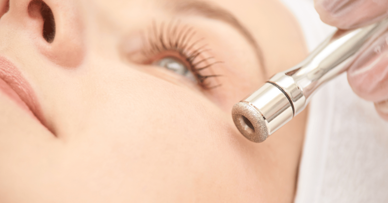 Саяногорск Инфо - Микродермабразия в клинике Алтеро - face.png