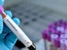 За сутки в Хакасии заболели коронавирусом 51 человек, 87 выздоровели