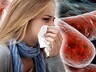 Туберкулез - как защитить себя и своих близких