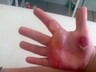 В Саяногорске проводится доследственная проверка по факту получения малолетним ребенком ожогов на детской горке
