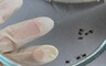 Среди жителей Хакасии растет число зараженных клещевым энцефалитом